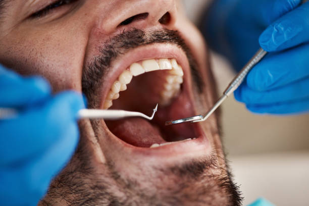 Best Emergency Treatment for Dental Infections or Abscesses in Barnesville, GA