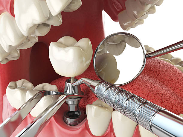Best Emergency Dental Care for Broken or Chipped Teeth in Barnesville, GA